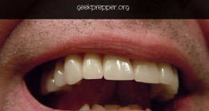 basics of a dental emergency kit